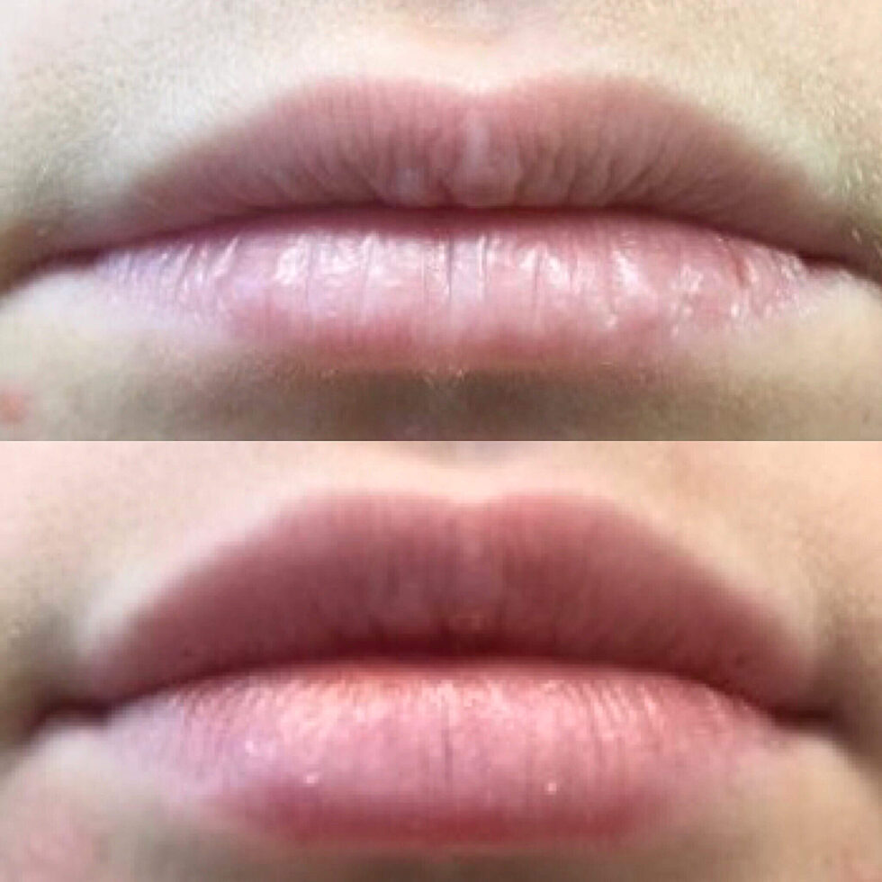 Long Island Cosmetic Dermatologist in Jericho, NY Cloudlake